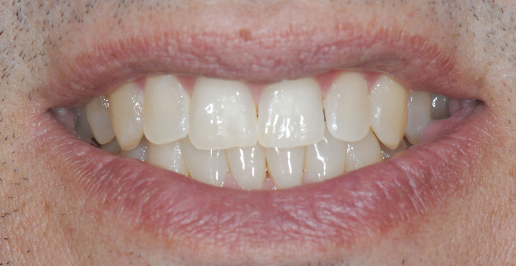 Smile Gallery Neosho, MO Family Dentistry of Neosho